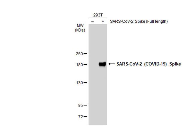 SARS-CoV-2 Spike Protein (RBD) Antibody in Western Blot (WB)