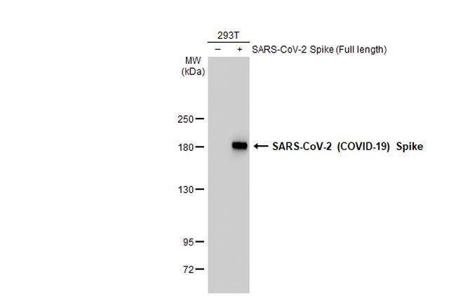 SARS-CoV-2 Spike Protein S2 Antibody in Western Blot (WB)