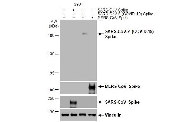 SARS-CoV-2 Spike Protein S2 Antibody in Western Blot (WB)