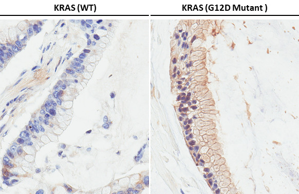 Ras (G12D Mutant) Antibody in Immunohistochemistry (Paraffin) (IHC (P))