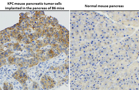 Ras (G12D Mutant) Antibody in Immunohistochemistry (Paraffin) (IHC (P))