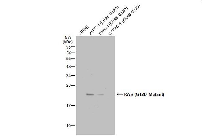 Ras (G12D Mutant) Antibody in Western Blot (WB)