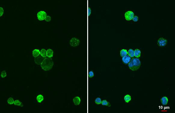 IBA1 Antibody in Immunocytochemistry (ICC/IF)