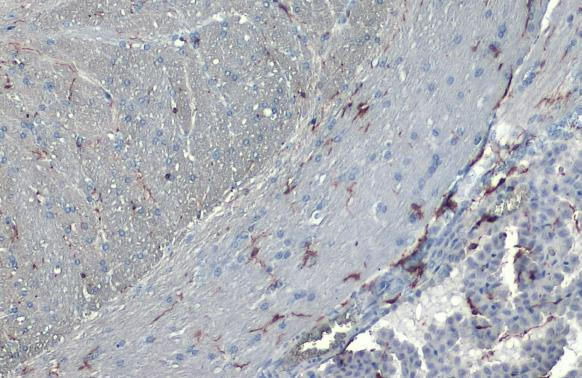 IBA1 Antibody in Immunohistochemistry (Paraffin) (IHC (P))