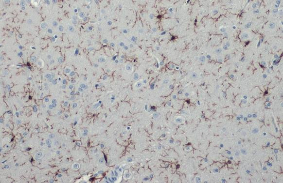 IBA1 Antibody in Immunohistochemistry (Paraffin) (IHC (P))