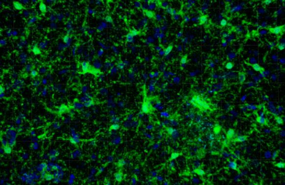 IBA1 Antibody in Immunohistochemistry (Paraffin) (IHC (P))