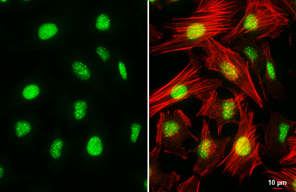 ATRX Antibody in Immunocytochemistry (ICC/IF)