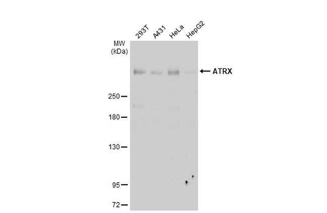 ATRX Antibody in Western Blot (WB)