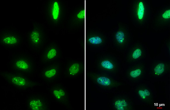 53BP1 Antibody in Immunocytochemistry (ICC/IF)