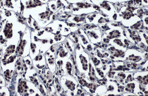 53BP1 Antibody in Immunohistochemistry (Paraffin) (IHC (P))