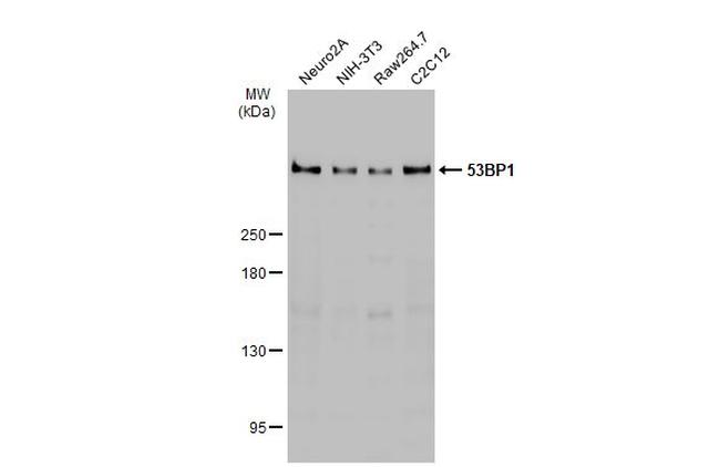 53BP1 Antibody in Western Blot (WB)