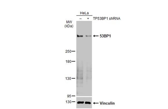 53BP1 Antibody in Western Blot (WB)