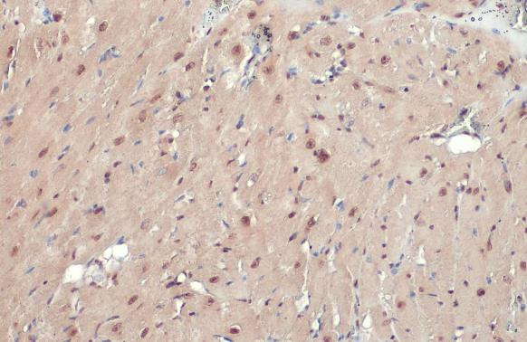 Phospho-ATR (Thr1989) Antibody in Immunohistochemistry (Paraffin) (IHC (P))