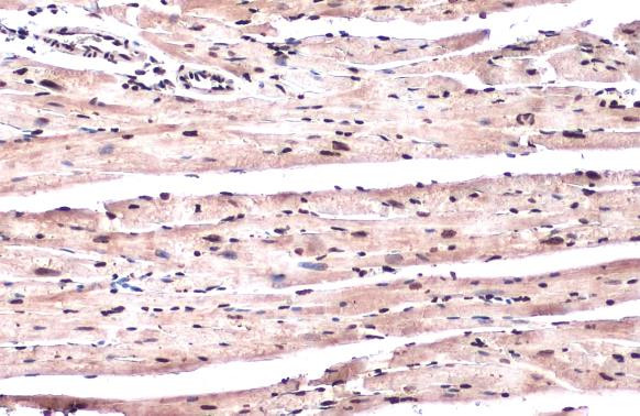 Phospho-ATR (Thr1989) Antibody in Immunohistochemistry (Paraffin) (IHC (P))