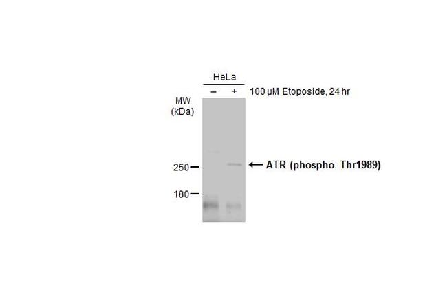 Phospho-ATR (Thr1989) Antibody in Western Blot (WB)