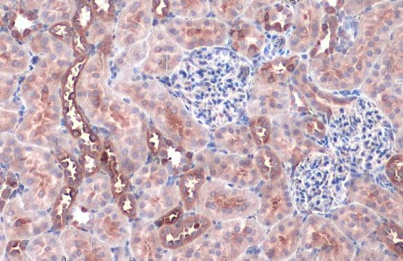 ACSL4/FACL4 Antibody in Immunohistochemistry (Paraffin) (IHC (P))