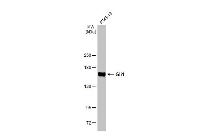 Gli1 Antibody in Western Blot (WB)