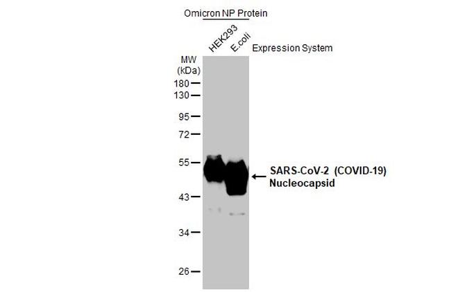 SARS-CoV-2 Nucleocapsid Antibody in Western Blot (WB)