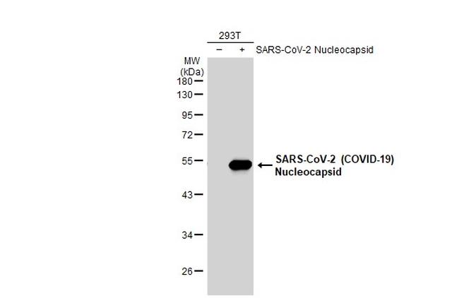 SARS-CoV-2 Nucleocapsid Antibody in Western Blot (WB)