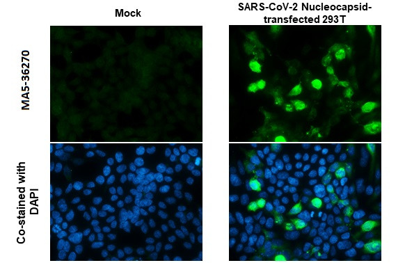 SARS-CoV-2 Nucleocapsid Antibody in Immunocytochemistry (ICC/IF)