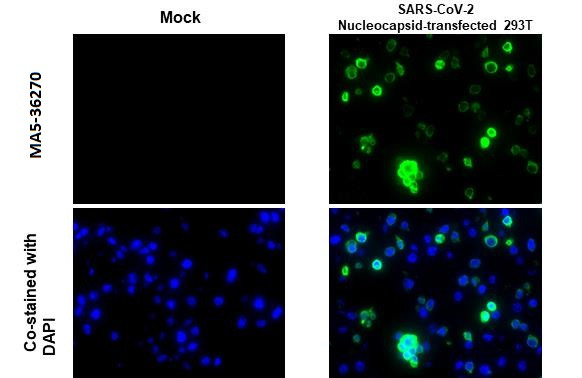 SARS-CoV-2 Nucleocapsid Antibody in Immunocytochemistry (ICC/IF)