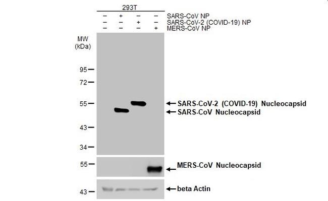 SARS-CoV-2 Nucleocapsid Antibody in Western Blot (WB)