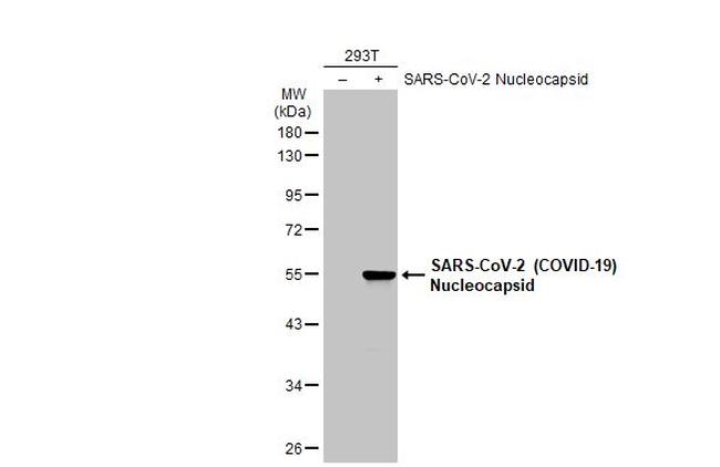 SARS-CoV-2 Nucleocapsid Antibody in Western Blot (WB)