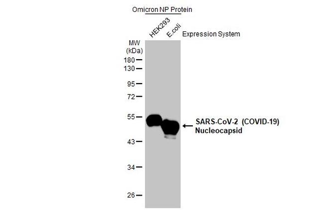 SARS-CoV-2 Nucleocapsid Antibody in Western Blot (WB)