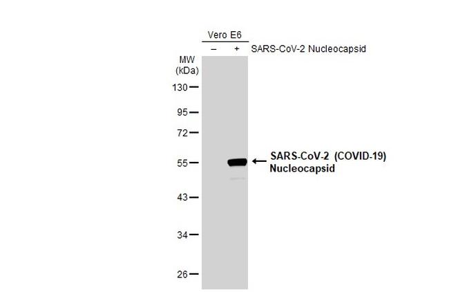 SARS-CoV-2 Nucleocapsid Antibody in Western Blot (WB)