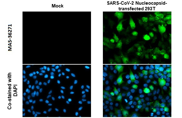 SARS-CoV-2 Nucleocapsid Antibody in Immunocytochemistry (ICC/IF)