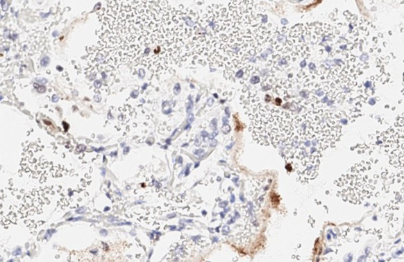 SARS-CoV-2 Nucleocapsid Antibody in Immunohistochemistry (Paraffin) (IHC (P))