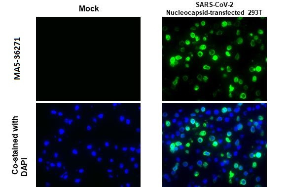 SARS-CoV-2 Nucleocapsid Antibody in Immunocytochemistry (ICC/IF)