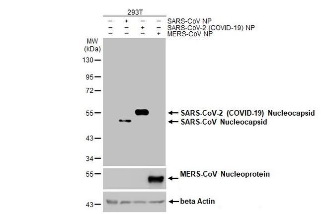 SARS-CoV-2 Nucleocapsid Antibody in Western Blot (WB)