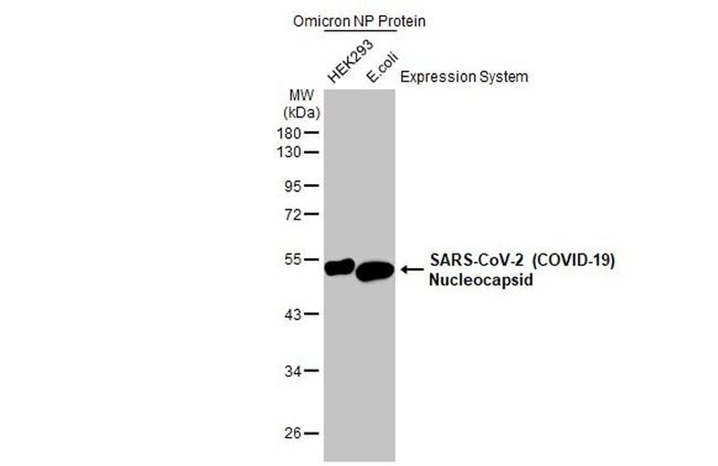 SARS-CoV-2 Nucleocapsid Antibody in Western Blot (WB)