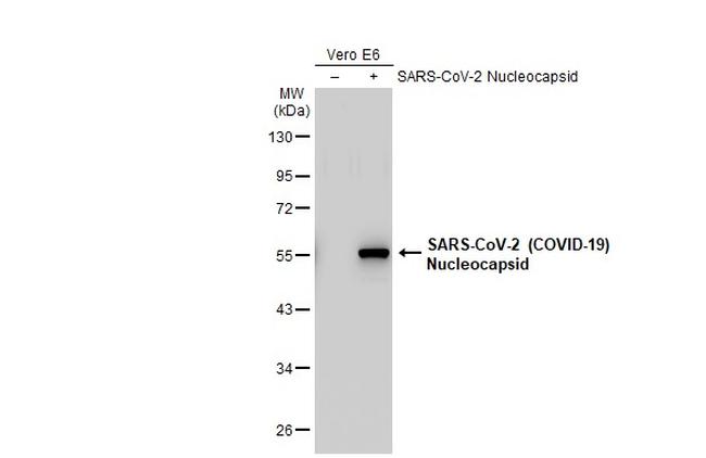 SARS-CoV-2 Nucleocapsid Antibody in Western Blot (WB)