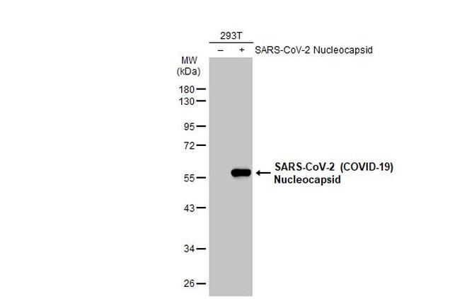 SARS-CoV-2 Nucleocapsid Antibody in Western Blot (WB)