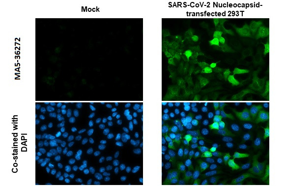 SARS-CoV-2 Nucleocapsid Antibody in Immunocytochemistry (ICC/IF)