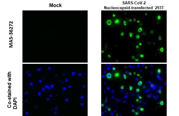 SARS-CoV-2 Nucleocapsid Antibody in Immunocytochemistry (ICC/IF)