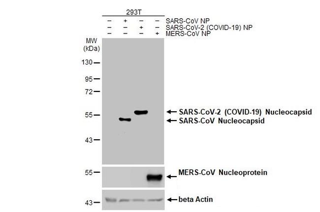 SARS-CoV-2 Nucleocapsid Antibody in Western Blot (WB)