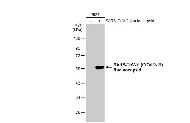 SARS-CoV-2 Nucleocapsid Antibody in Western Blot (WB)