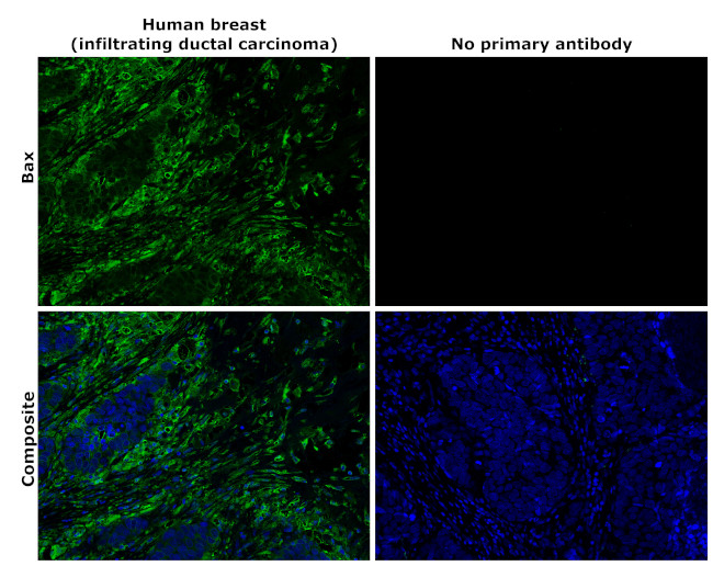 Bax Antibody in Immunohistochemistry (Paraffin) (IHC (P))