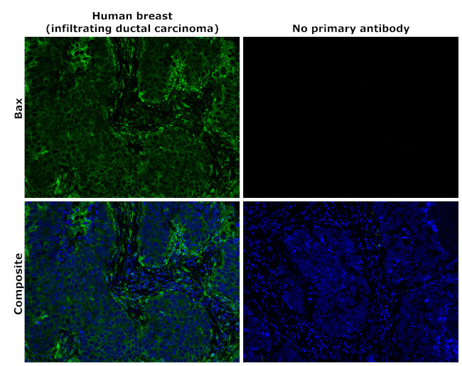 Bax Antibody in Immunohistochemistry (Paraffin) (IHC (P))