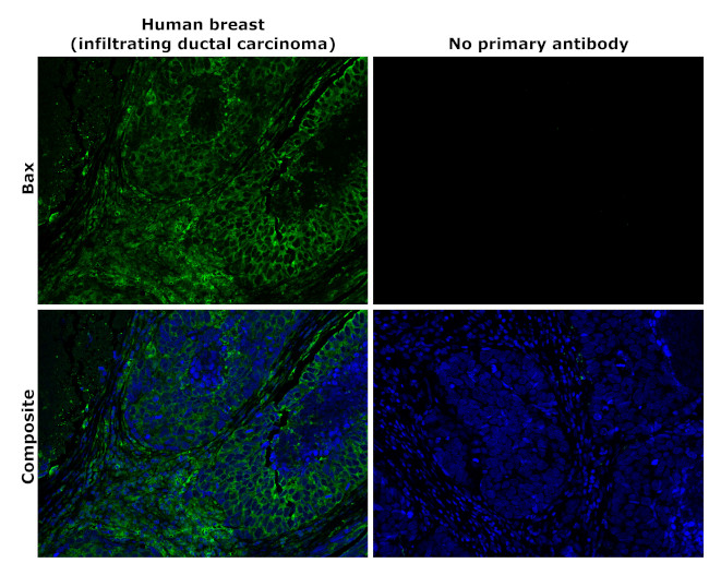 Bax Antibody in Immunohistochemistry (Paraffin) (IHC (P))