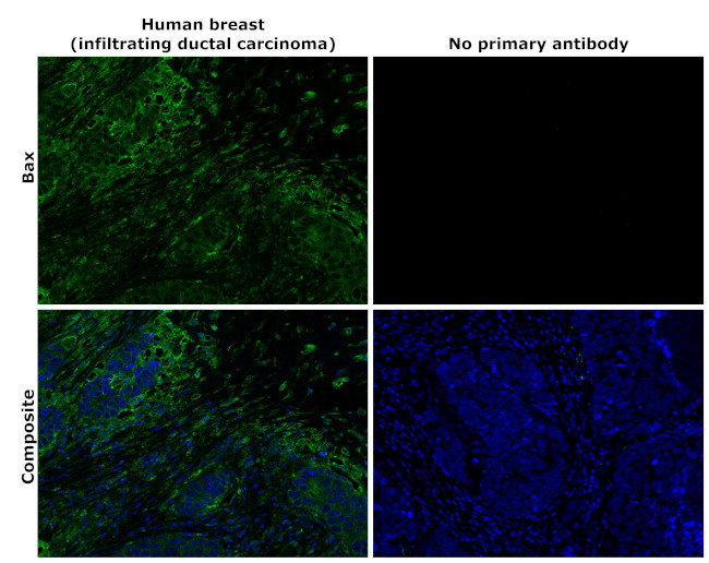 Bax Antibody in Immunohistochemistry (Paraffin) (IHC (P))