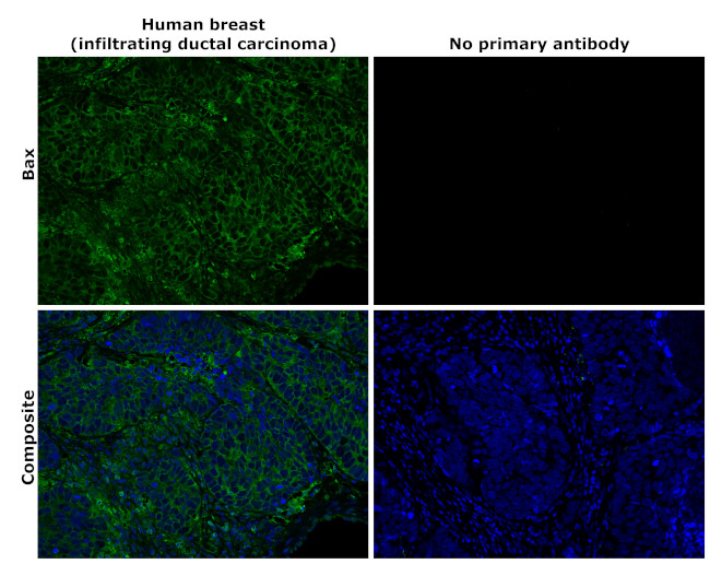 Bax Antibody in Immunohistochemistry (Paraffin) (IHC (P))