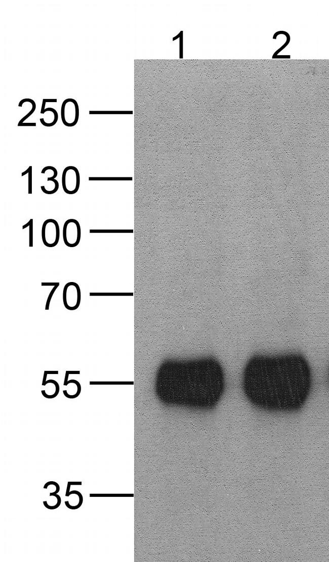 HAT Tag Antibody in Western Blot (WB)