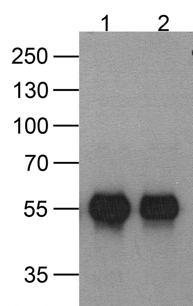 HAT Tag Antibody in Western Blot (WB)