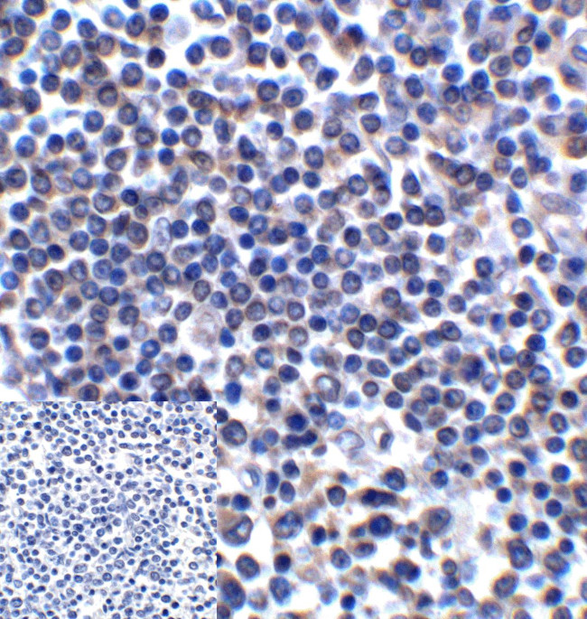 CD276 (B7-H3) Antibody in Immunohistochemistry (Paraffin) (IHC (P))