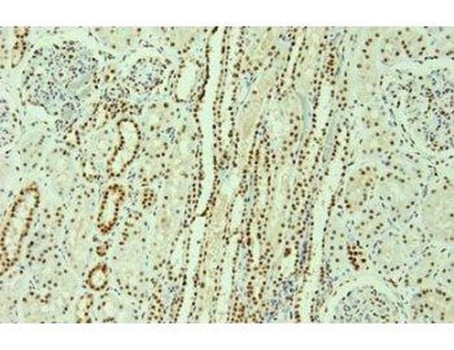 hnRNP F/H Antibody in Immunohistochemistry (Paraffin) (IHC (P))