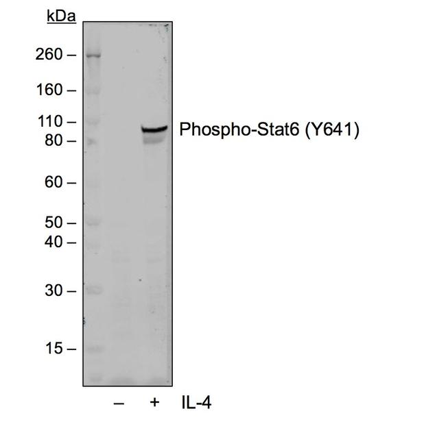 Phospho-Stat6 (Tyr641) Antibody in Western Blot (WB)